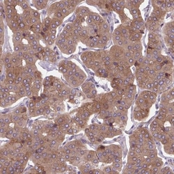 PLA2G4A Antibody, Novus Biologicals:Antibodies:Primary Antibodies